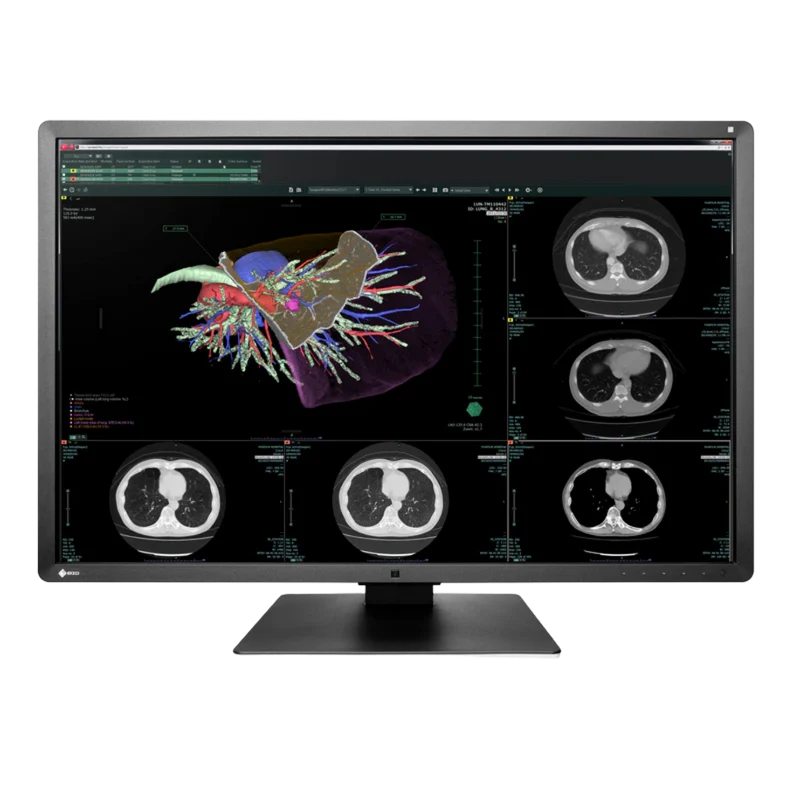 RadiForce 30p RX660 - Noir Occasion