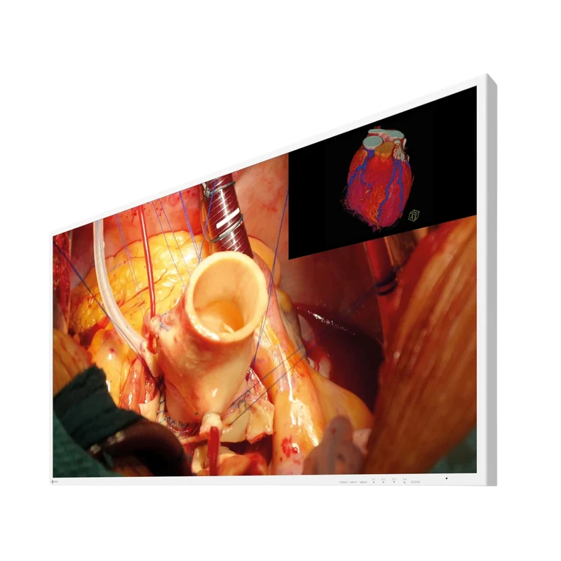CuratOR - 43p 4K UHD EX4342