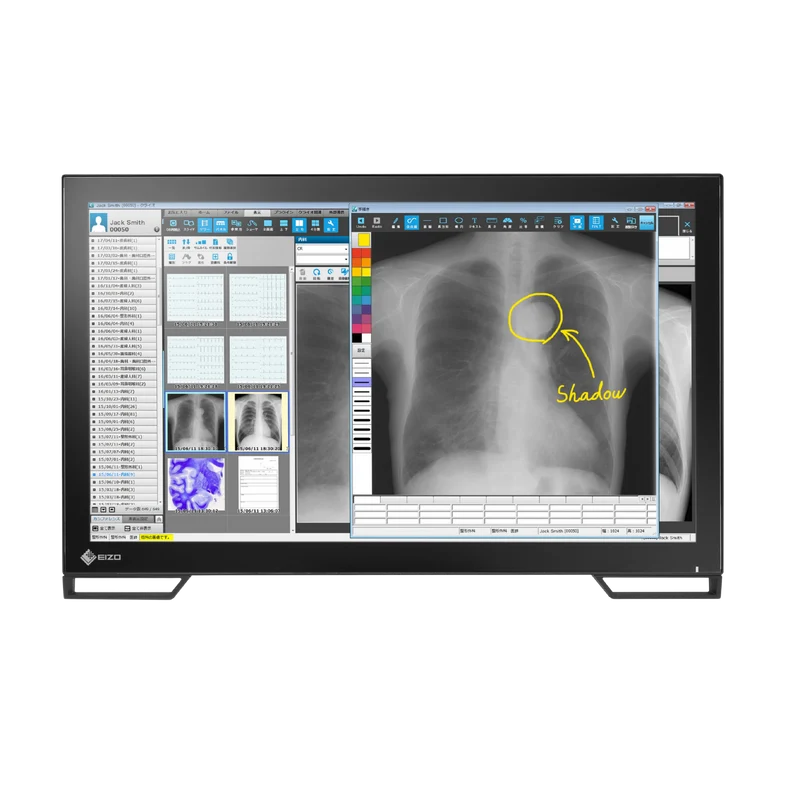 RadiForce 23p MS236WT-A