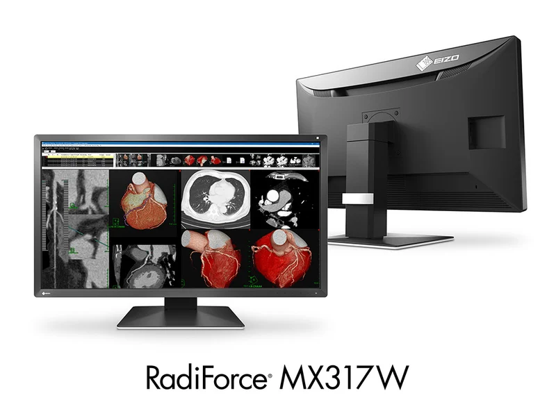 RadiForce 31p MX317W