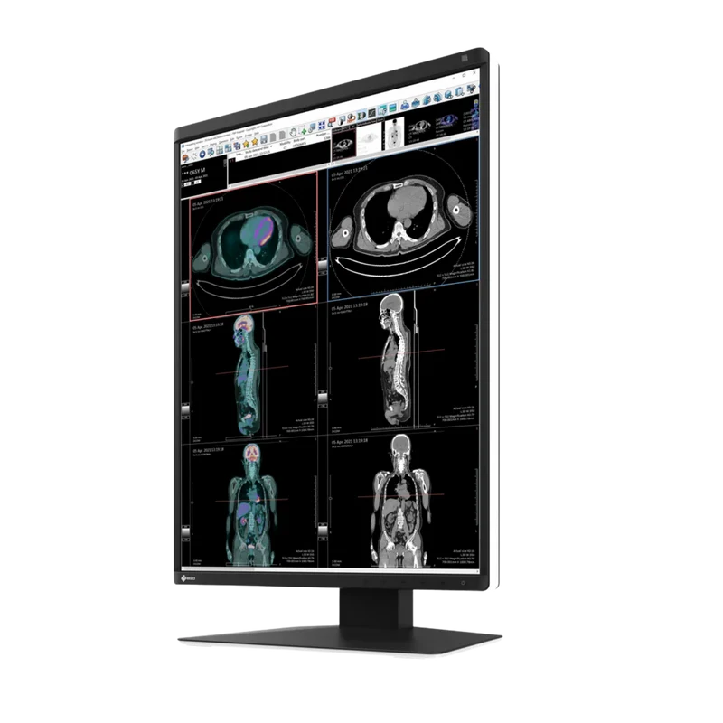 RadiForce 21p RX370
