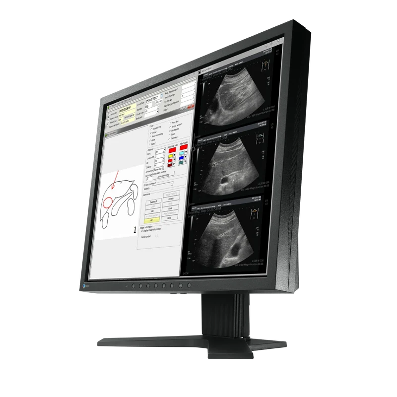 RadiForce 19p MX194