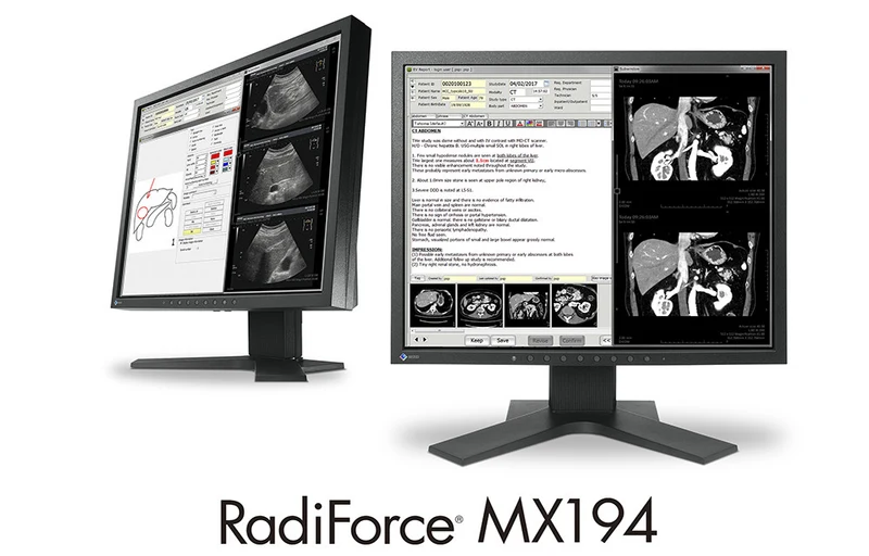 RadiForce 19p MX194
