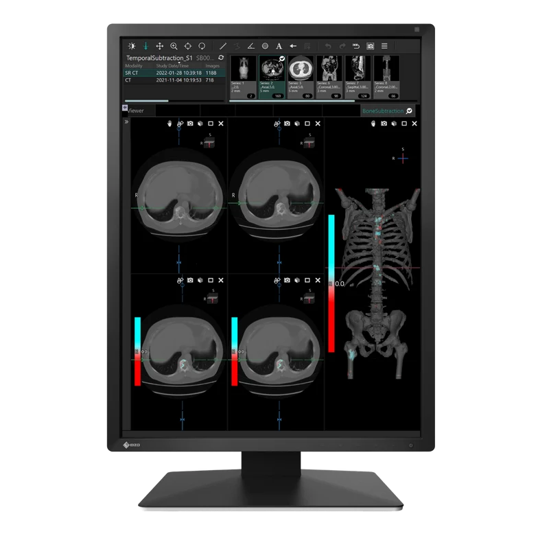 RadiForce 21p MX217