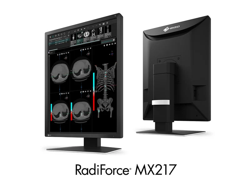 RadiForce 21p MX217