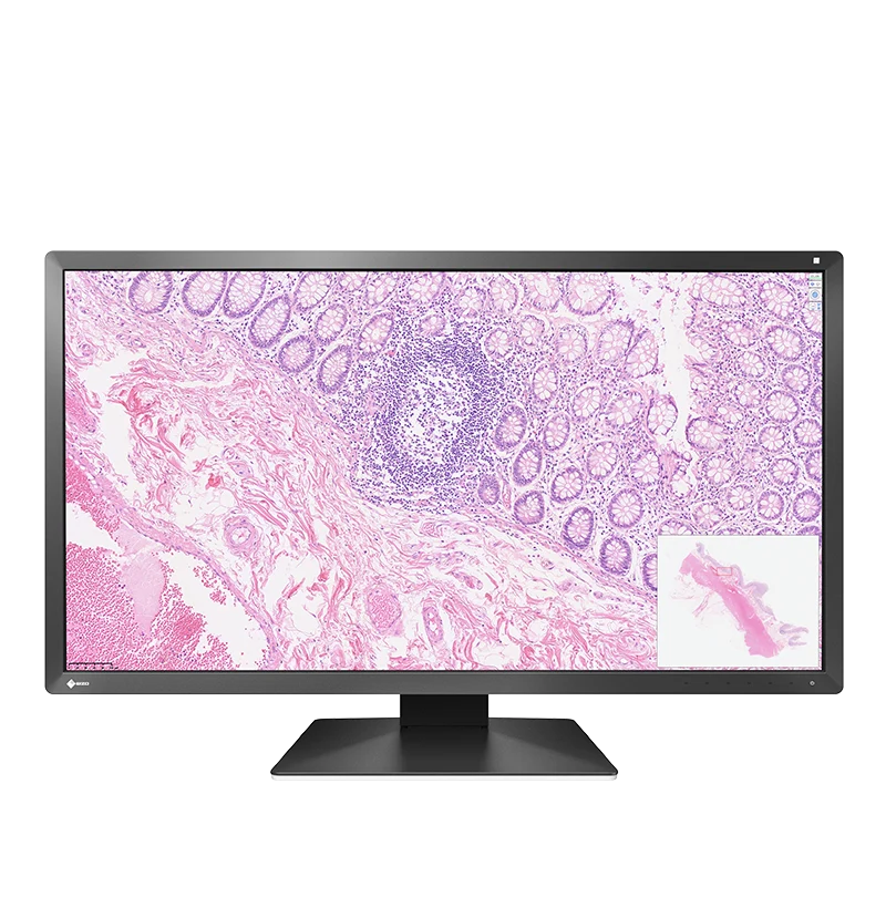 EIZO PX3150 – Écran de pathologie numérique