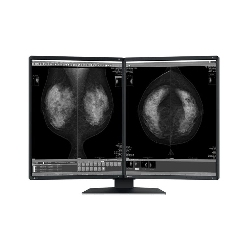 RadiForce 21p GX570-MD