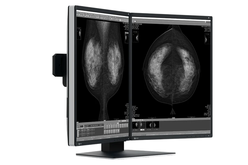 RadiForce 21p GX570-MD